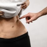 Ülseratif Kolit Nedir